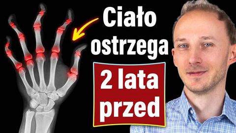 Pierwszy objaw niszczycielskiej choroby stawów