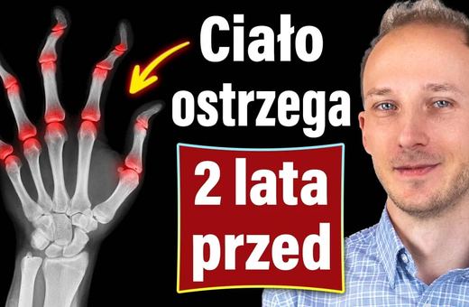 Pierwszy objaw niszczycielskiej choroby stawów
