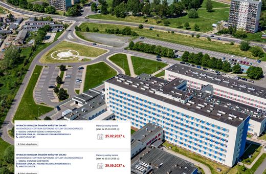 Na usunięcie żylaków trzeba czekać ponad 2 lata!