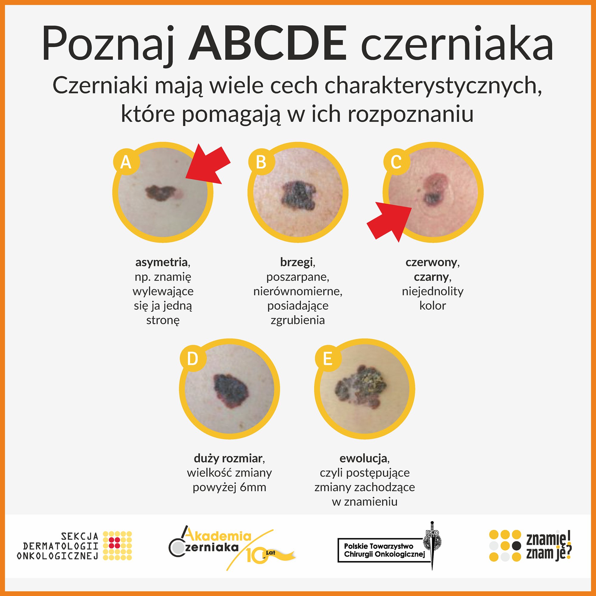 abc-czerniaka-100088