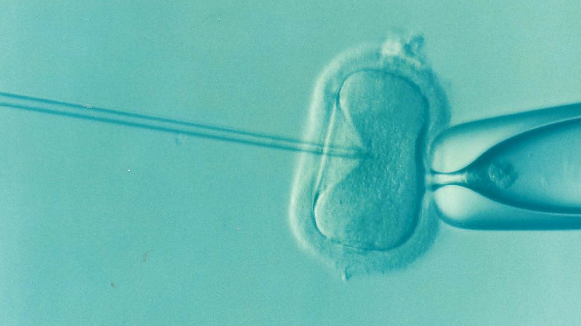 nabor-par-do-programu-in-vitro-w-jeleniej-gorze-112312
