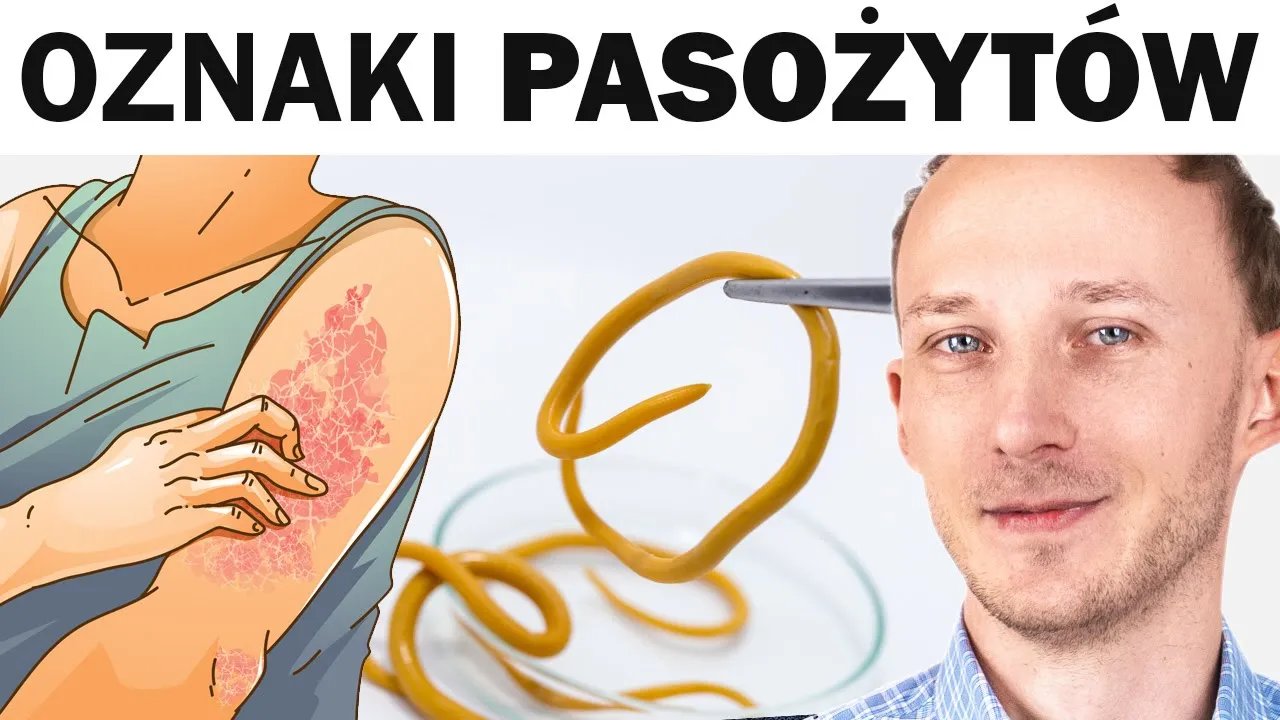 objawy-ze-pasozyty-grasuja-w-jelitach-jak-je-wygonic-121625