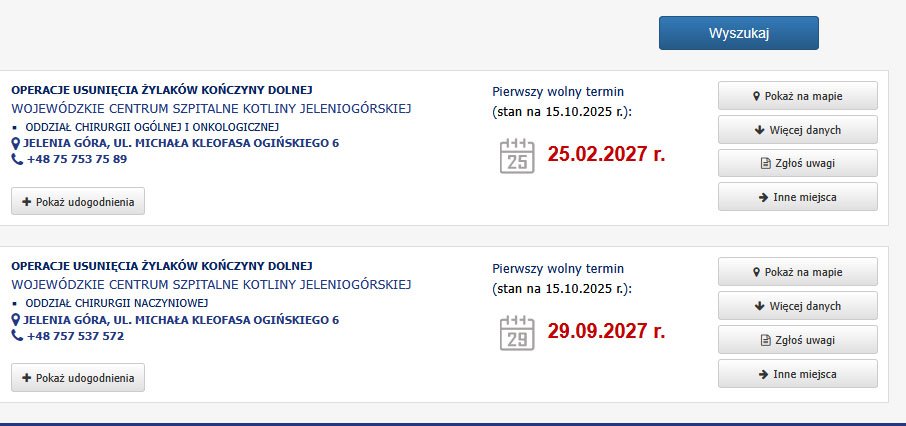 na-usuniecie-zylakow-trzeba-czekac-ponad-2-lata-136364