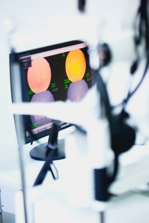 laseroterapia-narzadu-wzroku-43701