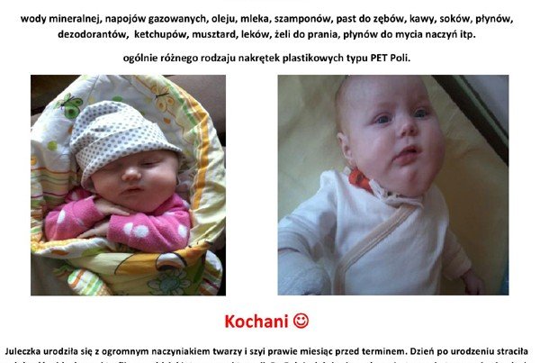 trwa-akcja-nakreteczki-dla-juleczki-przyacz-sie-43820