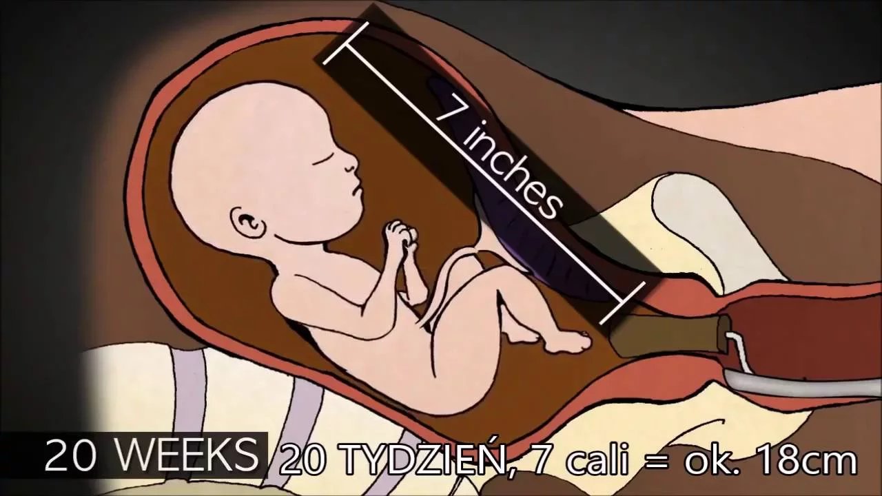 aborcja-w-2-trymestrze-ciazy-65317