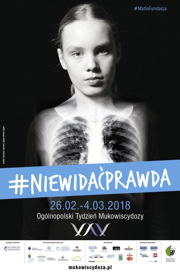 na-pomoc-chorym-na-mukowiscydoze-73686