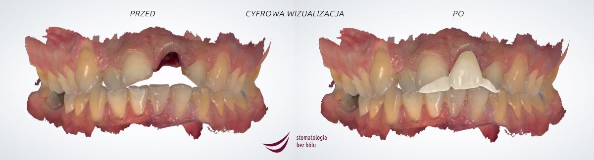 mogo-dojsc-do-tragedii-skonczyo-sie-tylko-na-utracie-zeba-92306