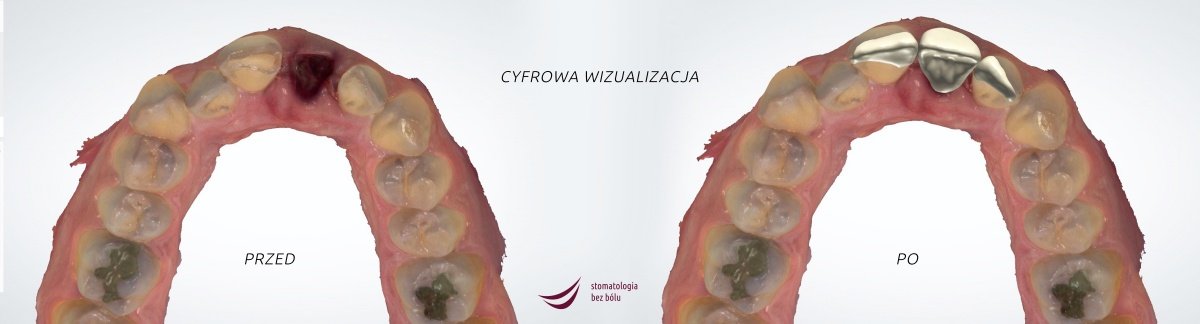 mogo-dojsc-do-tragedii-skonczyo-sie-tylko-na-utracie-zeba-92306
